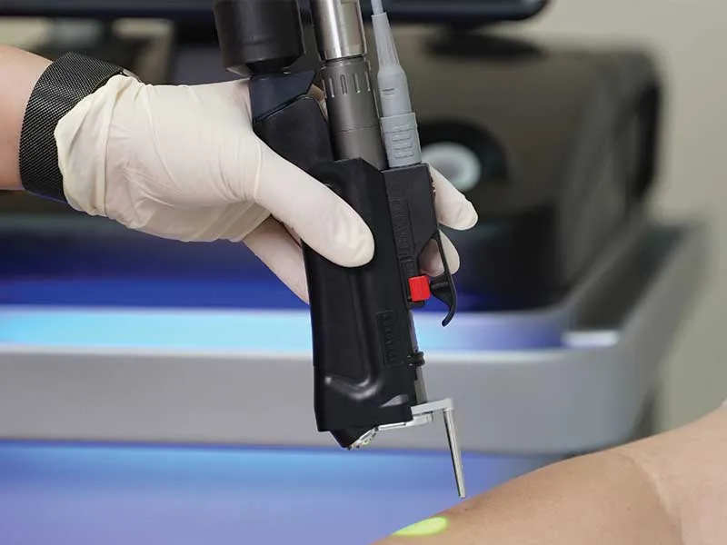 Elite iQ laser machine used for advanced aesthetic treatments at Soluna Medical in Las Vegas