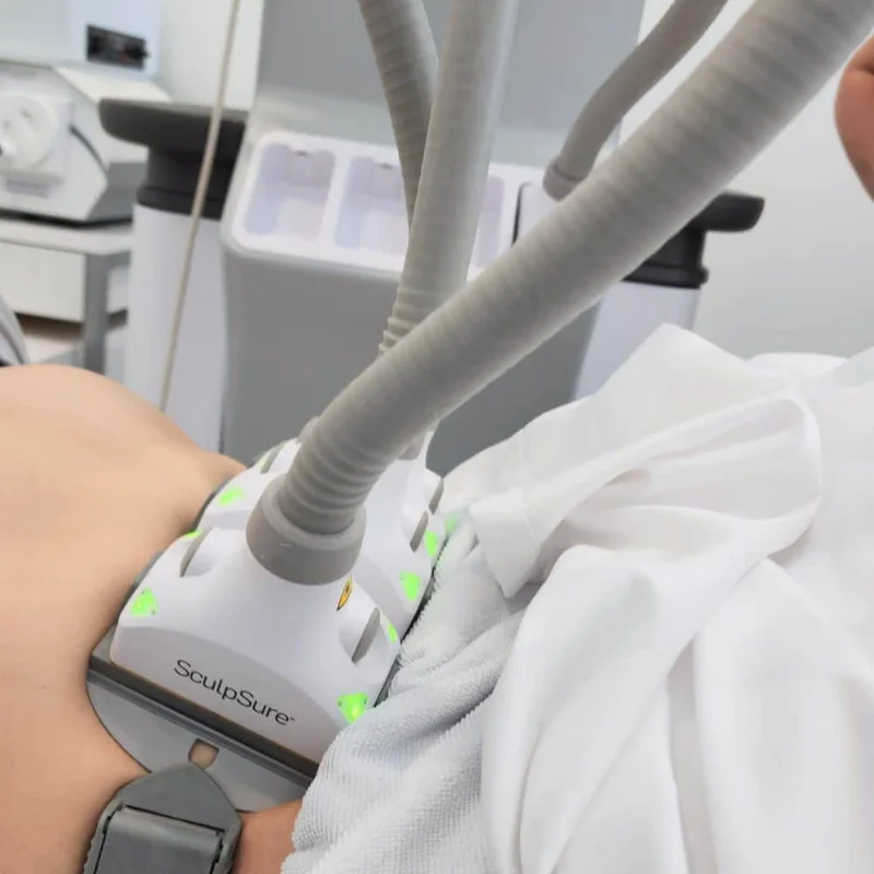 SculpSure body contouring procedure at Soluna Medical in Las Vegas